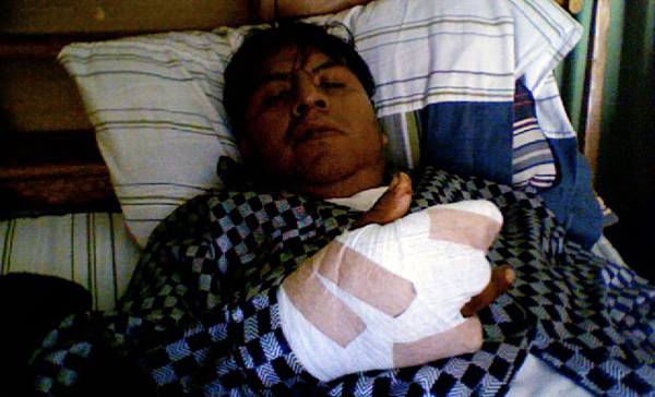 Rolando at home recovering after his surgery.